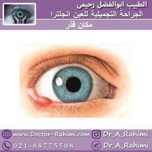 مكان قذر